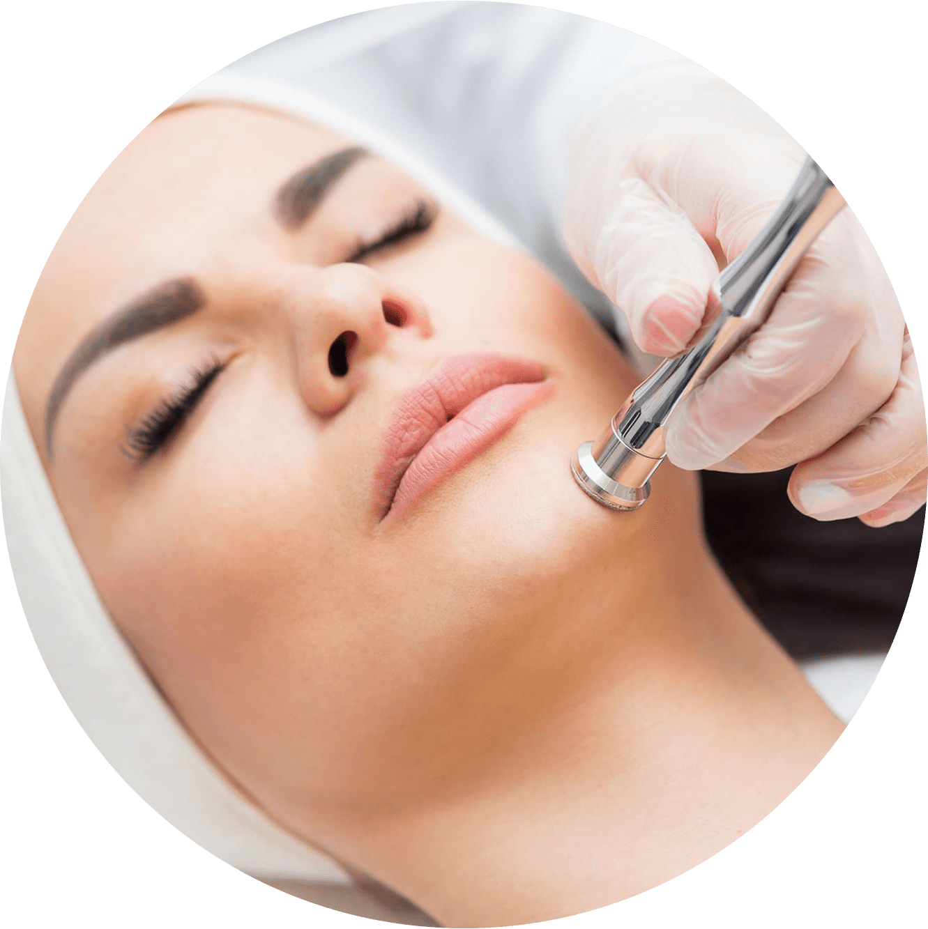 Dermabrasion